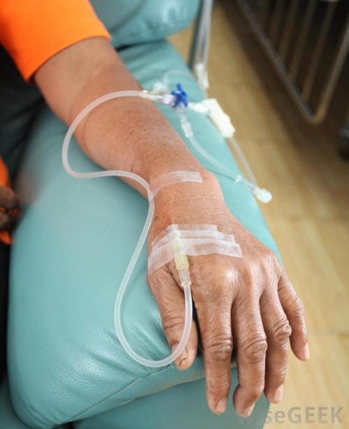 chemotherapy-hand-and-arm